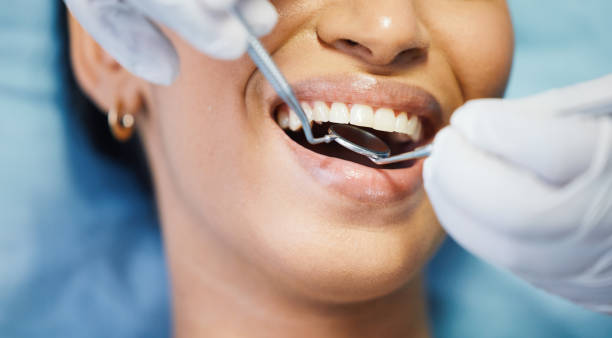 Best Emergency Tooth Extraction in Wahese, NC