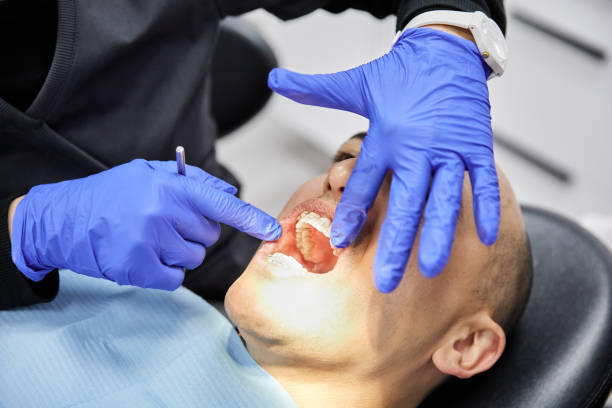Best Emergency Tooth Extraction in Wahese, NC